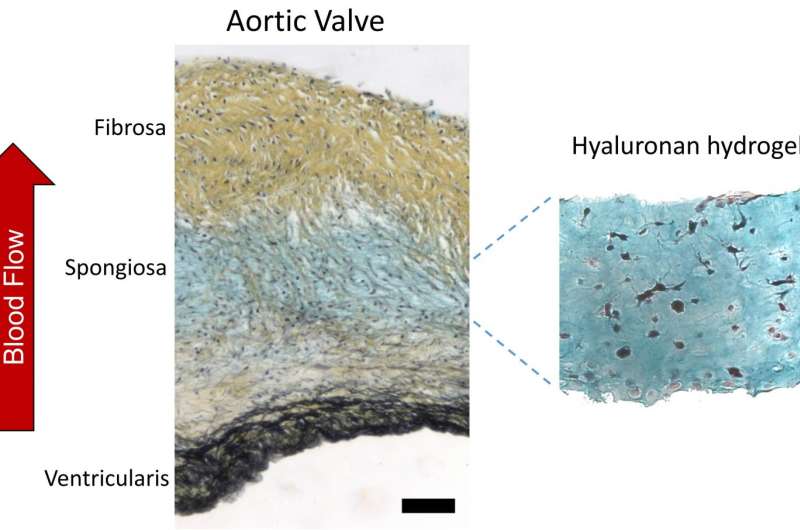 Study probes heart of synthetic heart valves