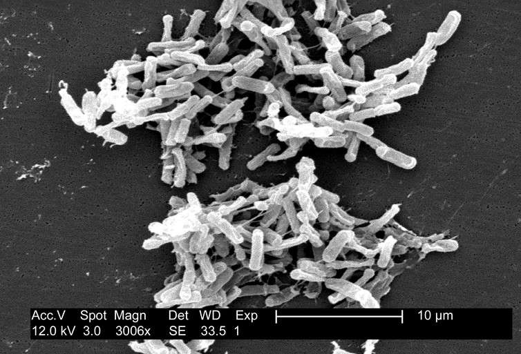 Study tracing ancestor microorganisms suggests life started in a hydrothermal environment