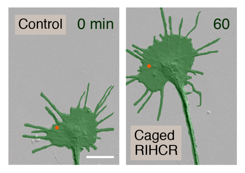 Turn left! How myosin-Va helps direct neuron growth