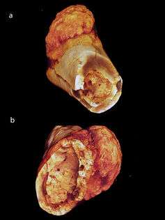What can a 1.7-million-year-old hominid fossil teach us about cancer?