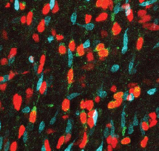 Why neural stem cells may be vulnerable to Zika infection