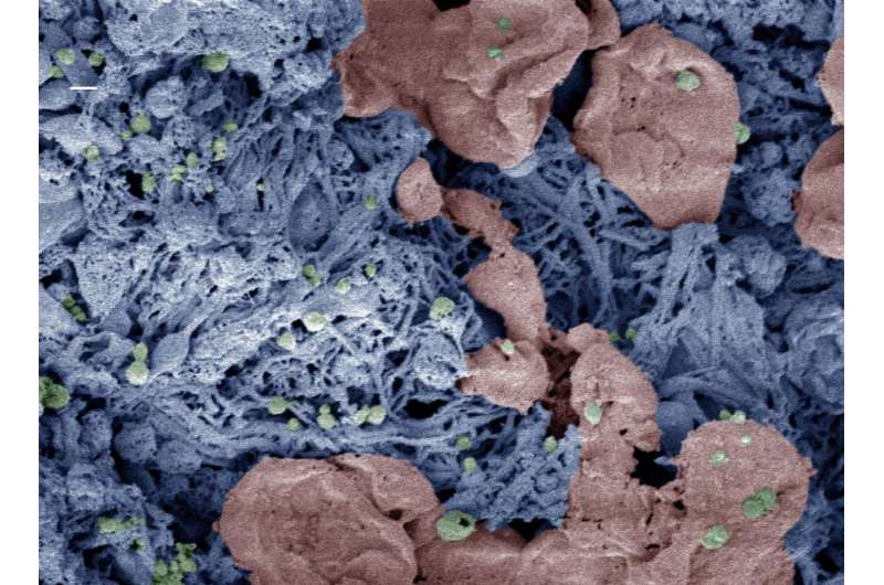 Nanoparticles that speed blood clotting may someday save lives