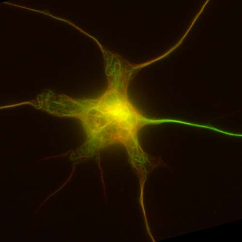 Researchers discover the machinery that neurons use to form and maintain their neuronal extensions