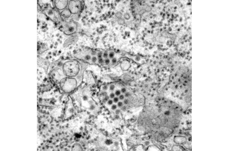 Nanoparticle vaccinates mice against dengue fever