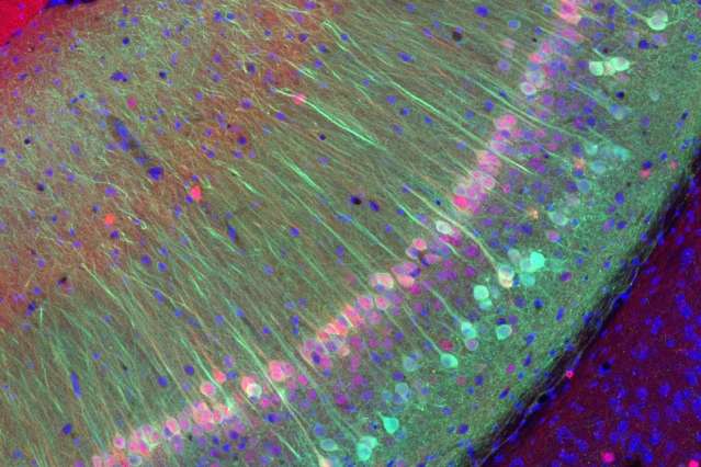Scientists identify neurons devoted to social memory