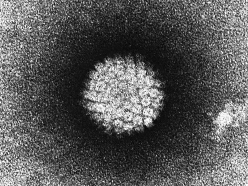 New research sheds light on role of HPV in head and neck cancers