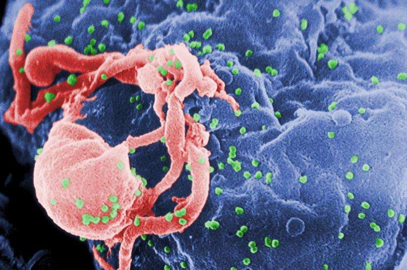 New insights into latent HIV infections