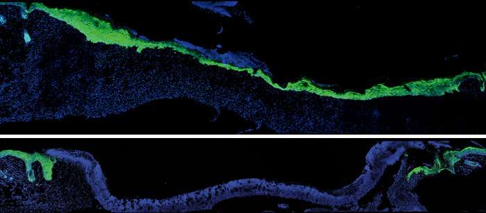 New research clarifies why wounds heal more slowly with age