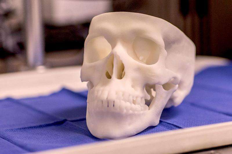 3-D printed skulls prepare new doctors while promoting world-class health care