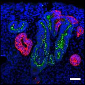 Expansion of kidney progenitor cells toward regenerative medicine