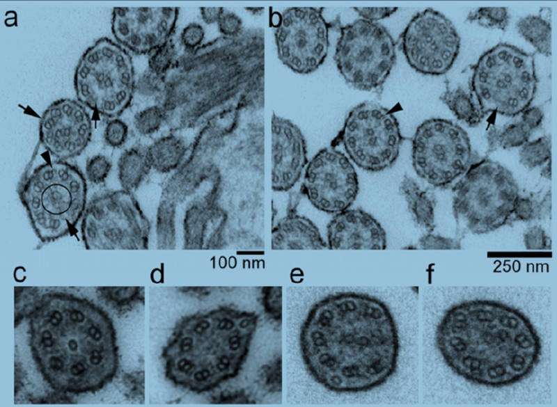 Gene mutation causes juvenile mortality in calves