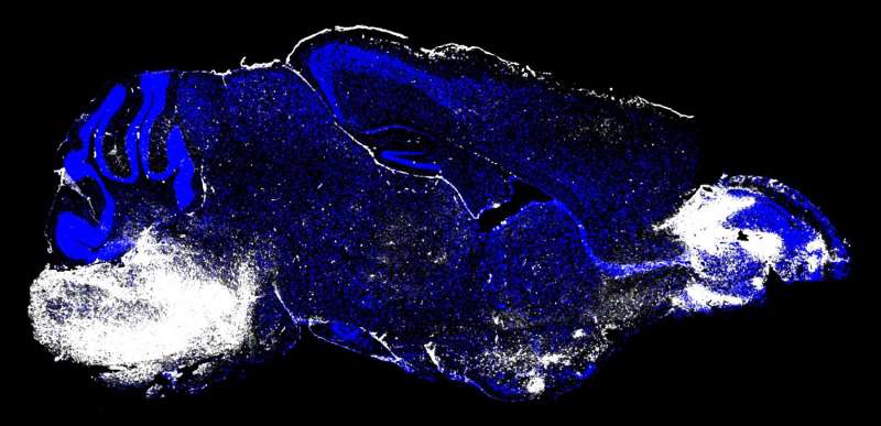 免疫系统细胞引起小鼠大脑严重的疟疾并发症