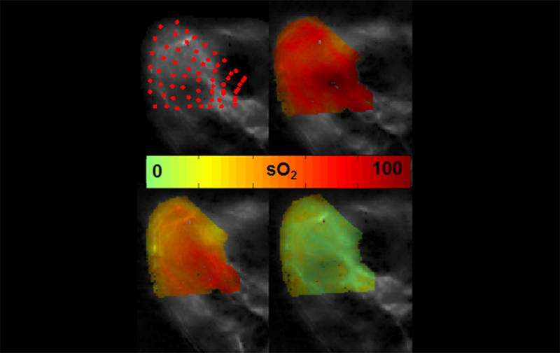 New non-invasive imaging method for showing oxygen in tissue