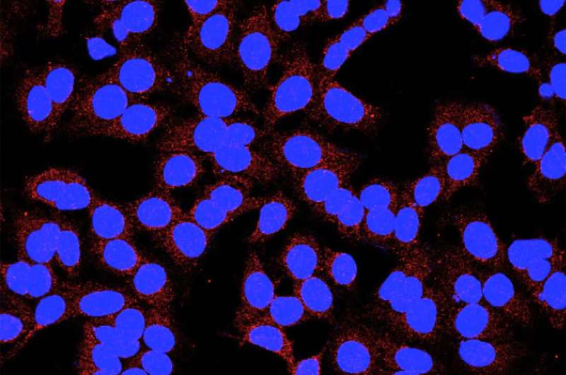 NUS scientists discover the 'switch' that makes breast cancer cells aggressive