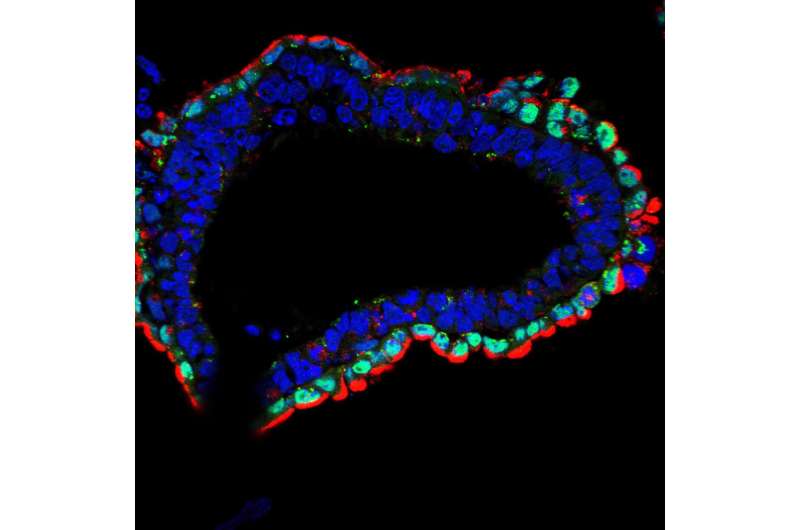 Salk scientists uncover how a cell's 'fuel gauge' promotes healthy development