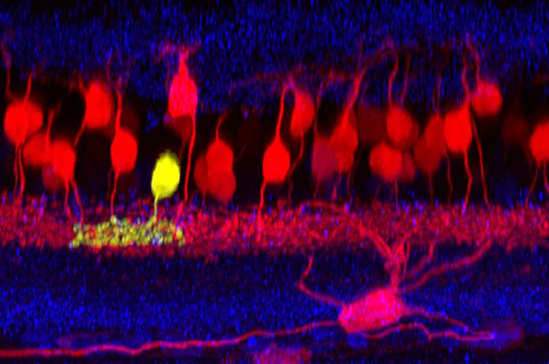 Scientific serendipity yields new neuron type in mouse retina