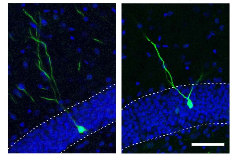小分子使新的成人神经元免于偏离，可以与精神分裂症捆绑在一起
