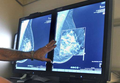 Study questions value of mammograms, breast cancer screening