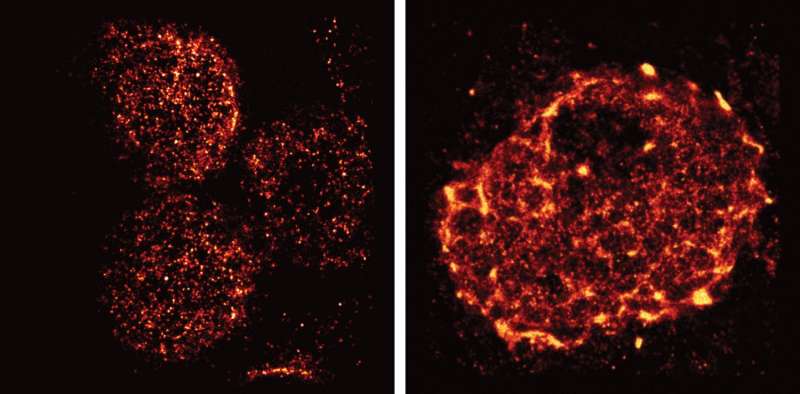 Super-resolution microscopy reveals unprecedented detail of immune cells' surface
