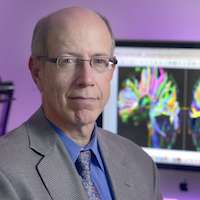 UTSW researchers find higher risk of mild cognitive impairment after traumatic brain injury