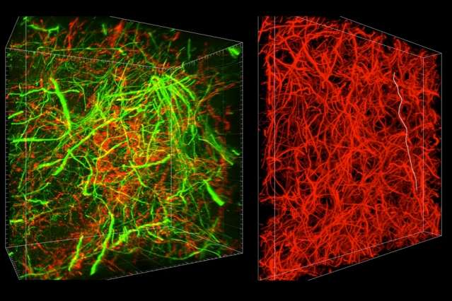 New technique can reveal subcellular brain details and long-range connections