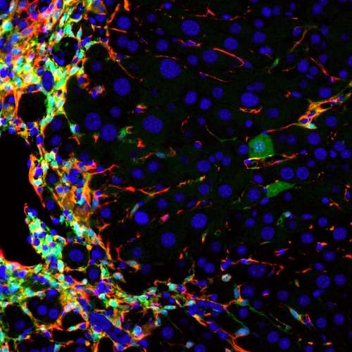 Researchers convert cirrhosis-causing cells to healthy liver cells in mice