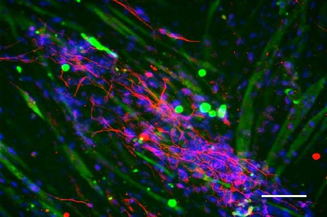 New technique generates human neural stem cells for tissue engineering, 3-D brain models