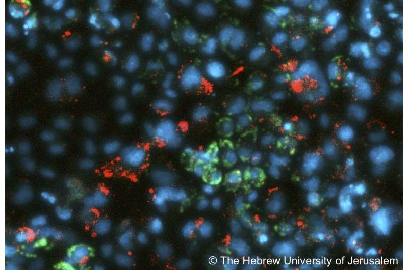 Scientists find new metabolic pathways to resist viruses
