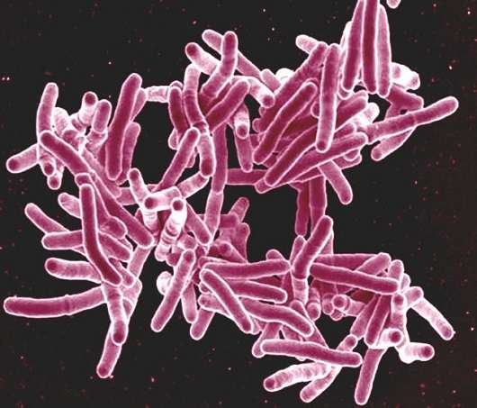 Accelerating tuberculosis research