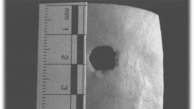Forensic research finds bone density affects size of bullet holes