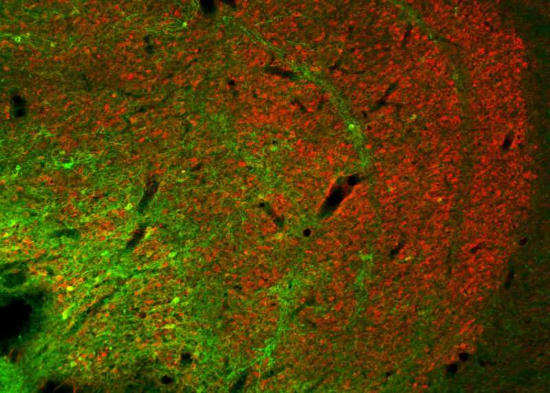 Optogenetics reveals new insights into circuits of the brain