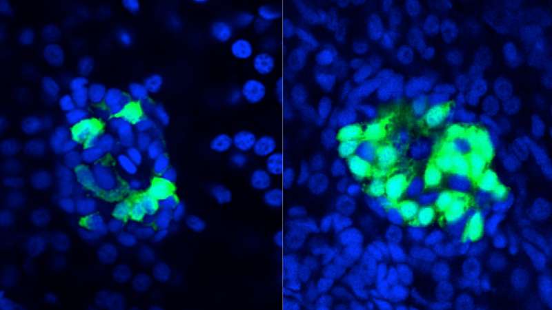 俄勒冈州的研究人员发现细菌蛋白质,促进胰岛素生产细胞在斑马鱼