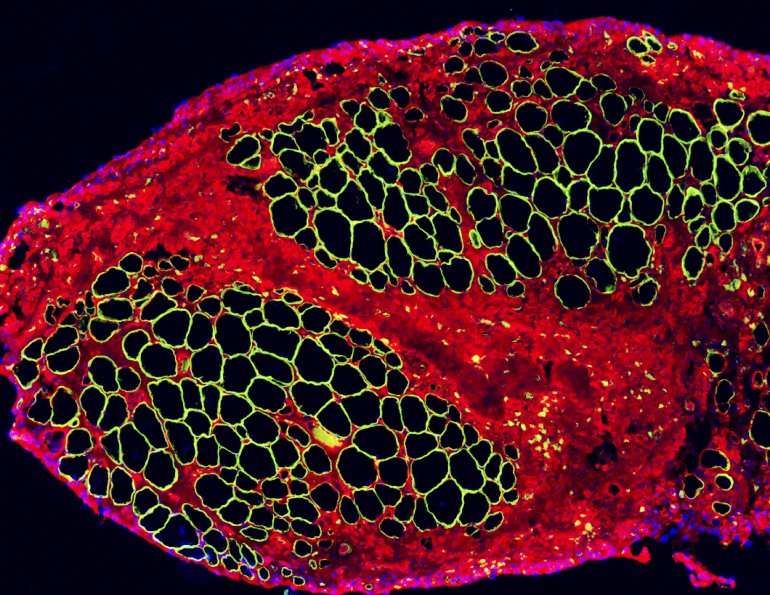 Regenerating muscle from stem cells
