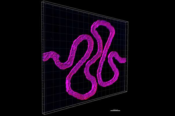 Scientists bioprint tubular 3-D renal architecture that recapitulates functions of the kidney