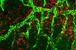 Scientists reveal new target for anti-lymphangiogenesis drugs