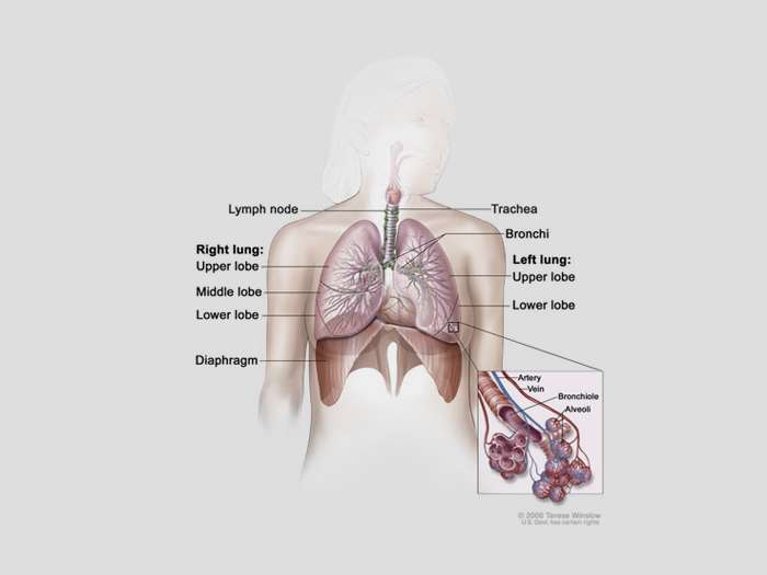Study identifies possible marker for lung cancer chemotherapy