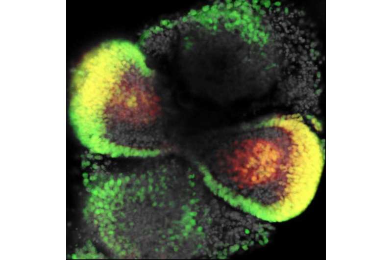 3-D 'mini-retinas' grown from mouse and human stem cells