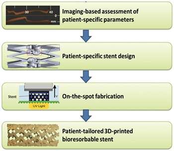 3-D printing customized vascular stents