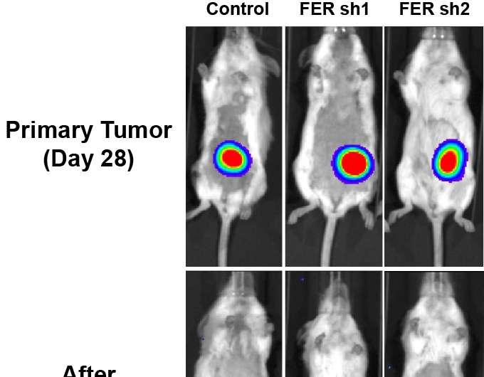 Discovery of new ovarian cancer signaling hub points to target for limiting metastasis