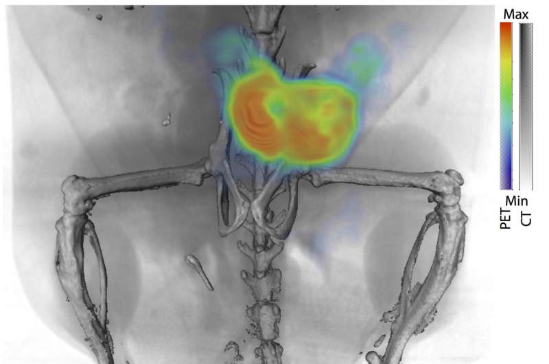 New imaging method can detect, monitor and guide treatment for, prostate cancer