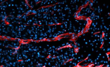 Regenerative stem cell active in human blood vessels could help patients with diabetes and cardiovascular disease