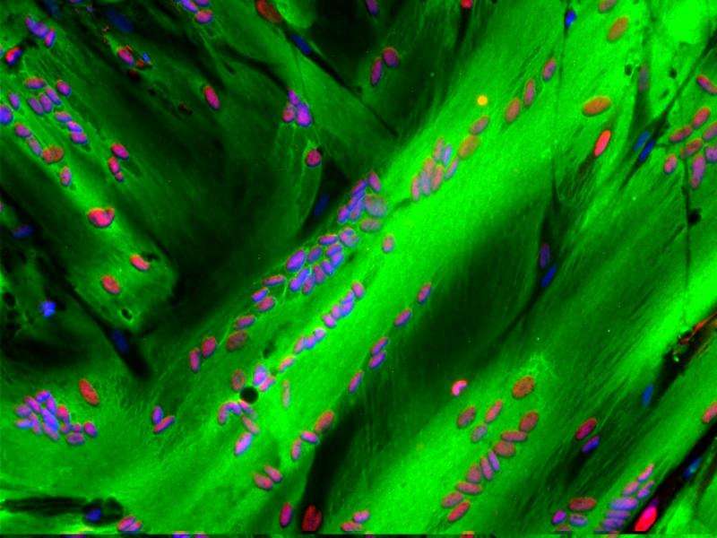 Researchers resolve longstanding issue of components needed to regenerate muscle