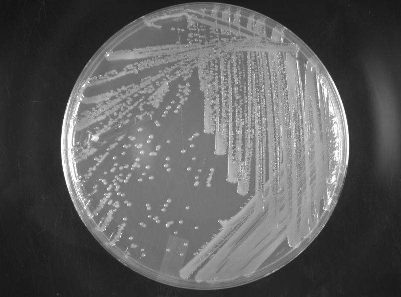 Research sheds light on mechanism that leads to drug-resistant superbugs