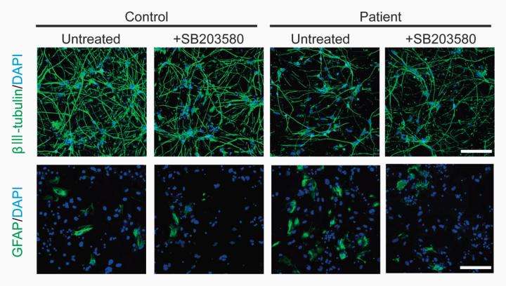 Schizophrenic stem cells do not differentiate properly into neurons
