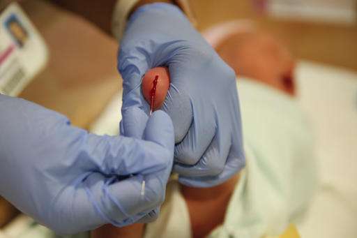 Storing babies' blood samples pits privacy versus science