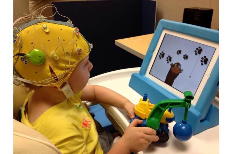 Researchers study how cochlear implants affect brain circuits