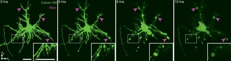 Researchers image brain cells' reactions to concussive trauma