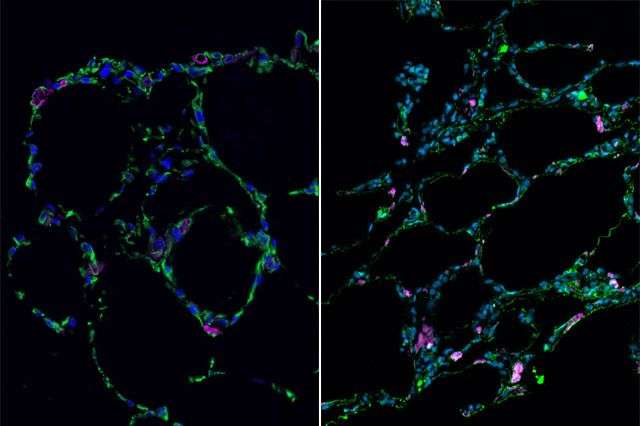 researchers use stem cells to grow 3-D lung-in-a-dish