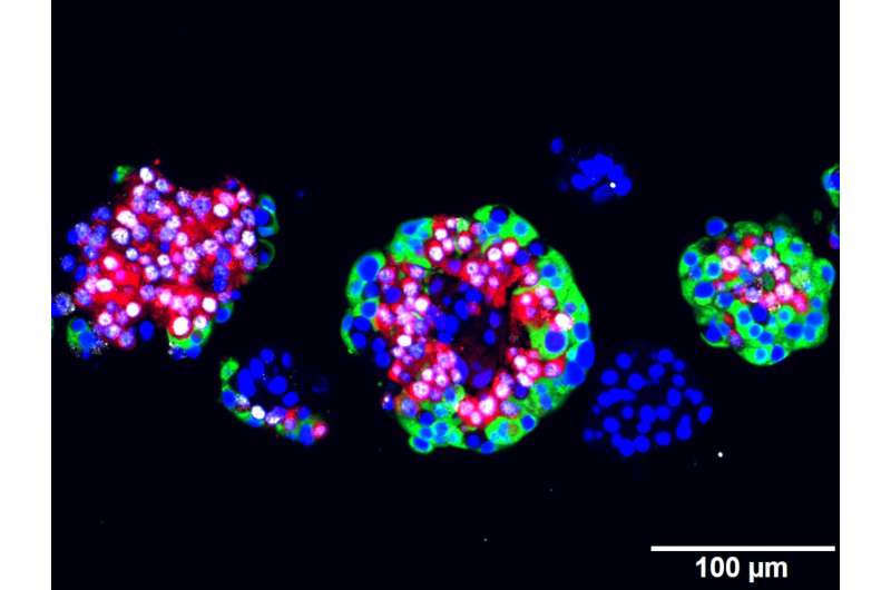 Breakthrough in diabetes research: Cells produce insulin upon artemisinin treatment