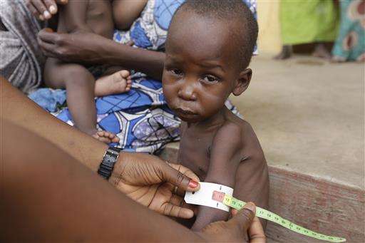 49,000 kids dying of malnutrition linked to Boko Haram: UN